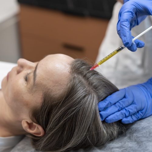 high-angle-patient-getting-prp-injection-alopecia