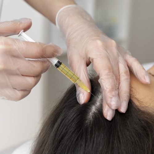 high-angle-woman-getting-scalp-prp-treatment